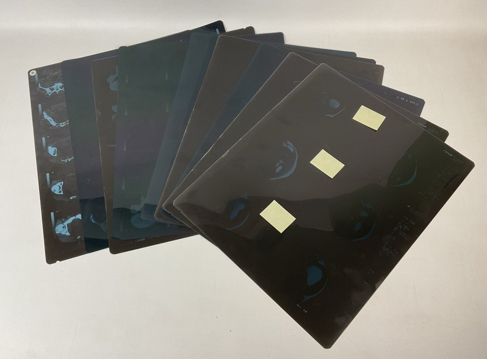 Lot Of 12 Used X-Ray Films-Hip-Pelvis-shoulder-Oddity