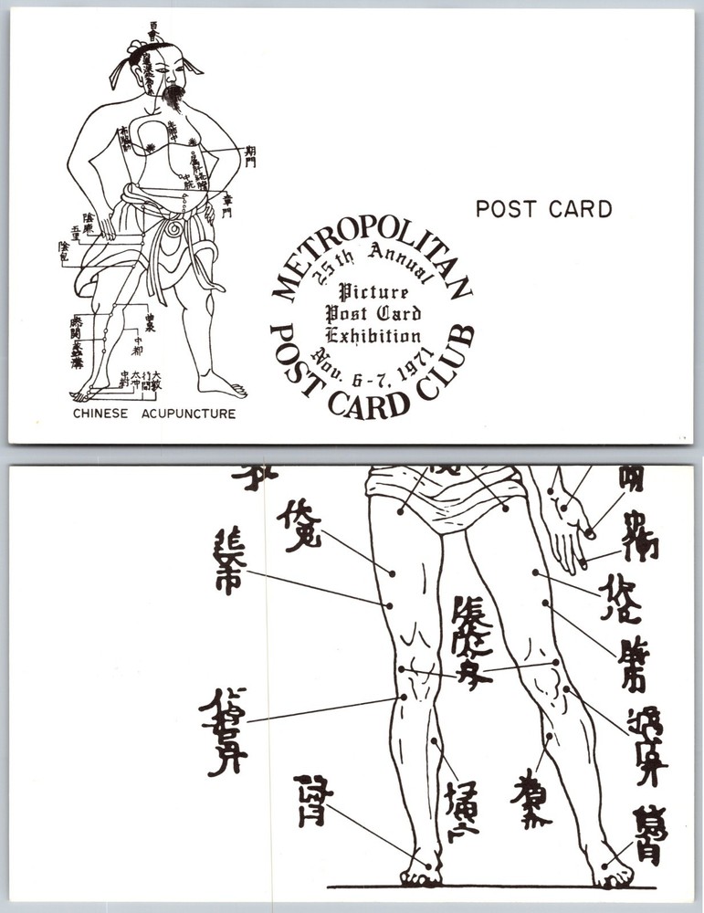 Chinese Acupuncture Diagram Postcard