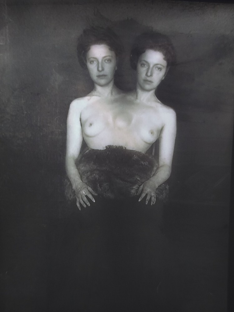 VINTAGE - NEGATIVE -  Siamese twins -  CIRCUS SHOW - HORROR - FREAK